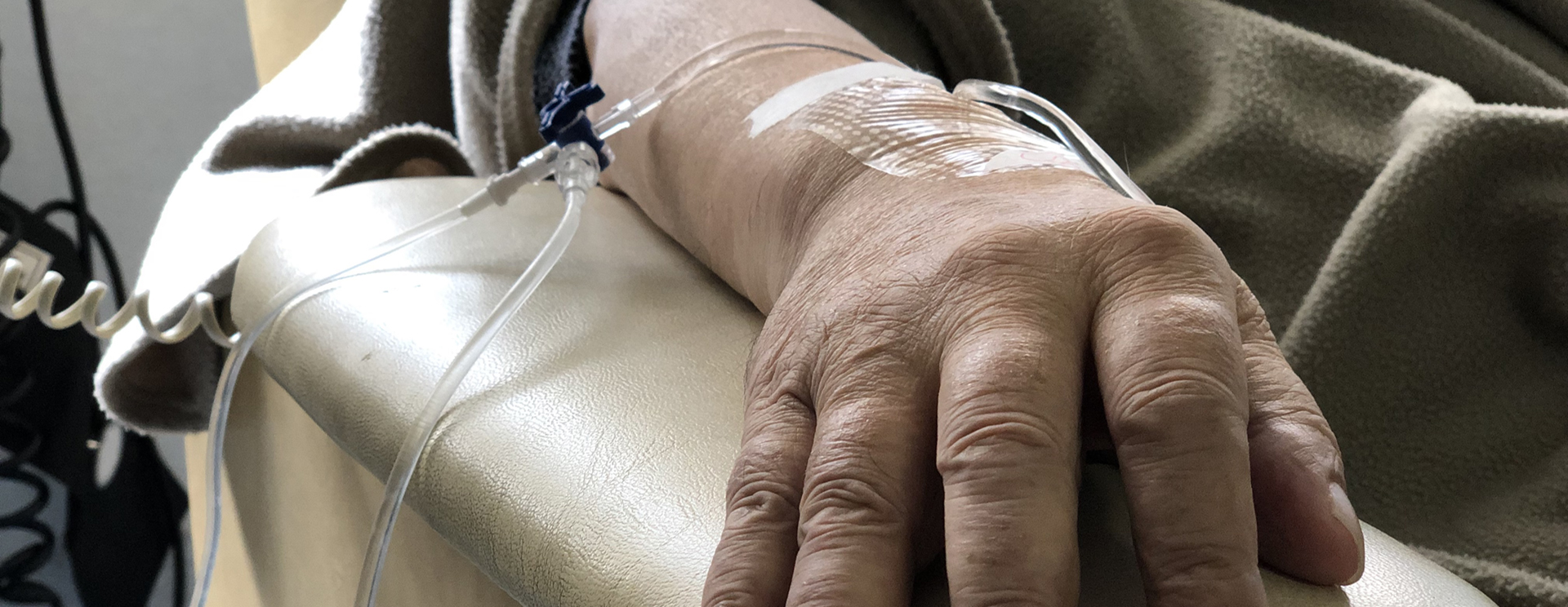 close up of woman's arm getting chemotherapy infusion