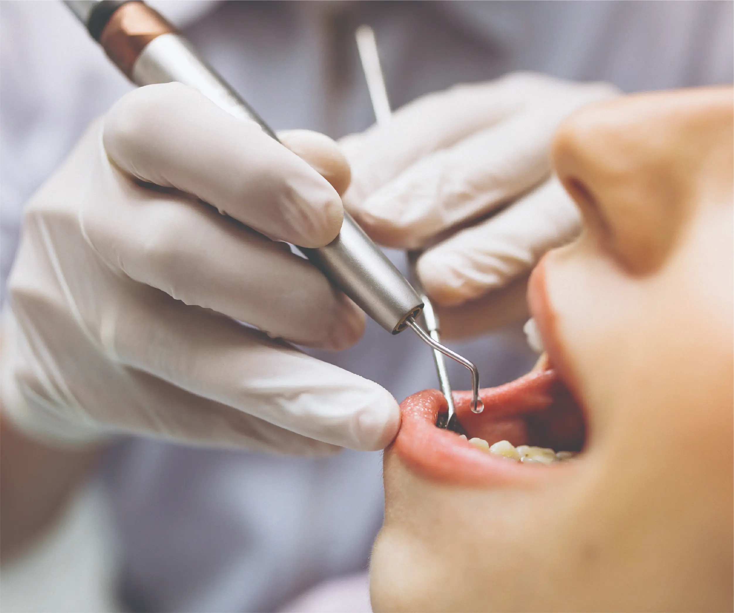 Dental Care Services in Bronx, NY